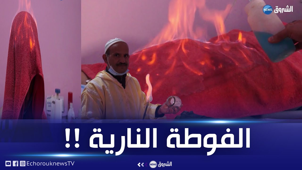 المسيلة| الفوطة النارية .. طب بديل وعلاج  لعدة أمراض