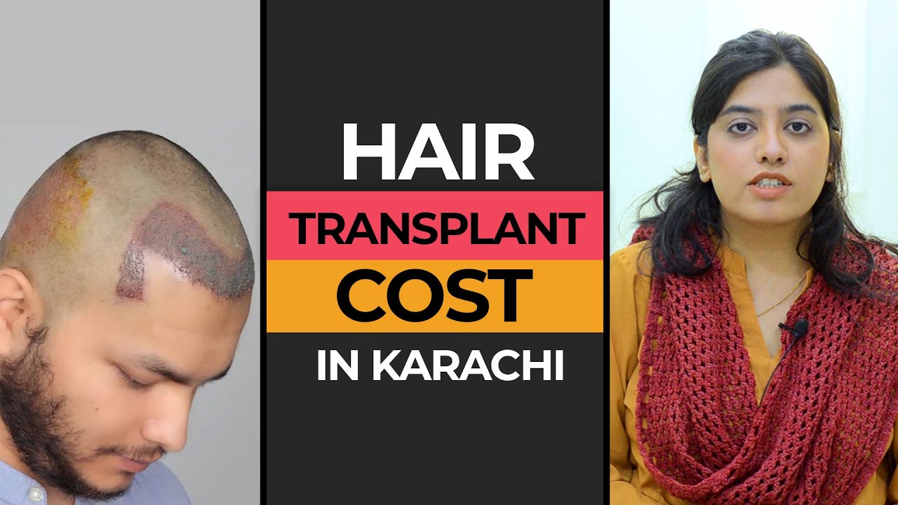 Hair Transplant Cost in Karachi - Price Per Graft of Hair Transplantation