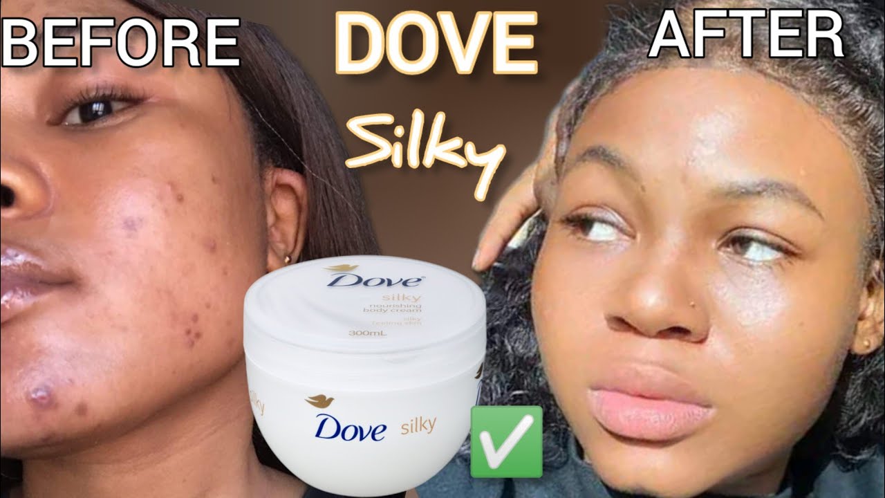 SKINCARE For  Pimple FREE skin✨Get rid of DarKspots!DOVE SILKY NOURISHING CREAM  review