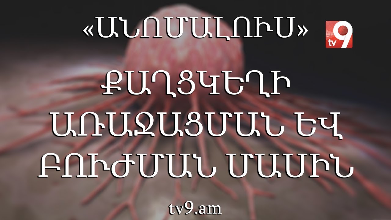 Քաղցկեղի առաջացման և բուժման մասին․ «Անոմալուս» Կարեն Եմենջյանի հետ։