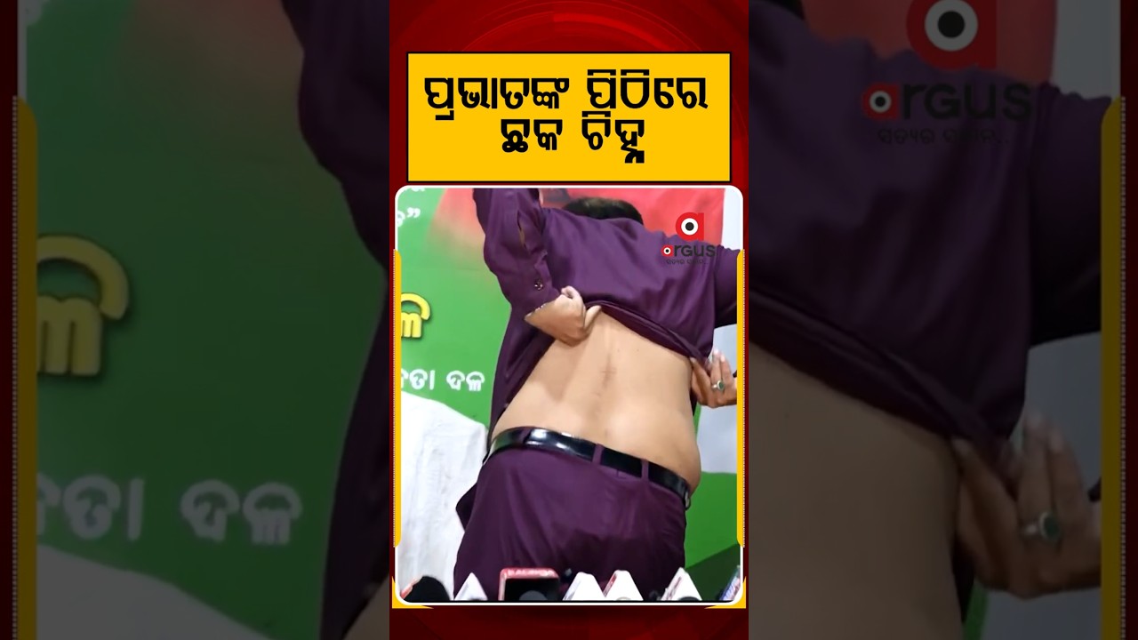 ପ୍ରଭାତଙ୍କ ପିଠିରେ ଛକ ଚିହ୍ନ | Pravat Biswal | Political Update | Odisha Politics | Argus Reels