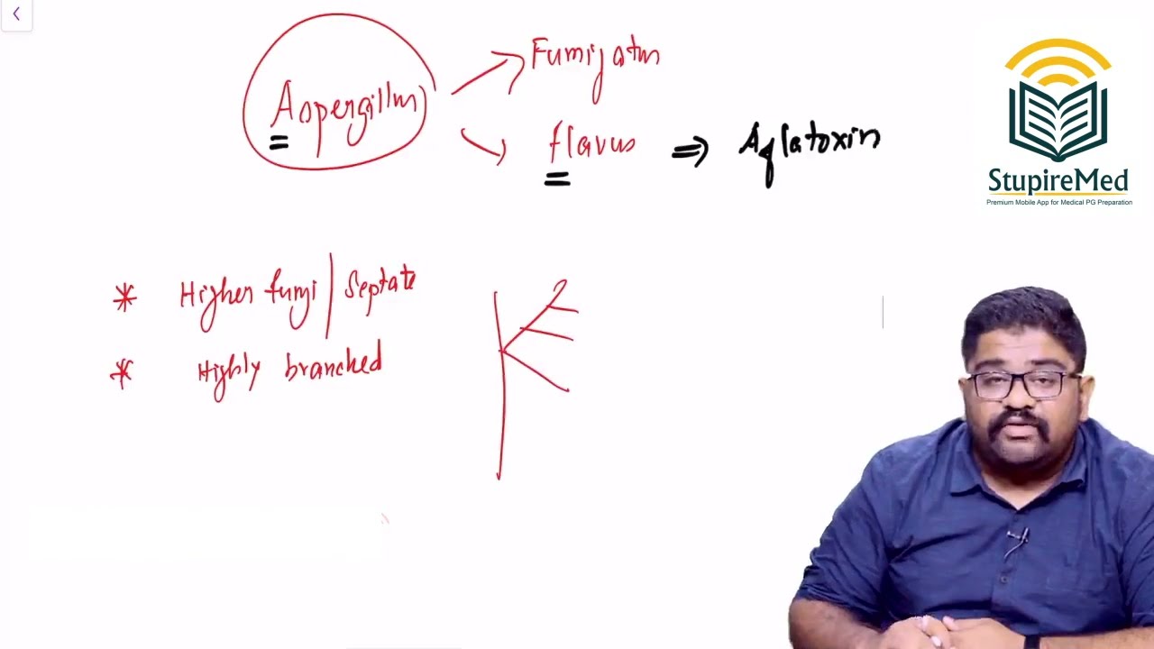 Aspergillosis By Dr. Meenakshi Sundaram A S