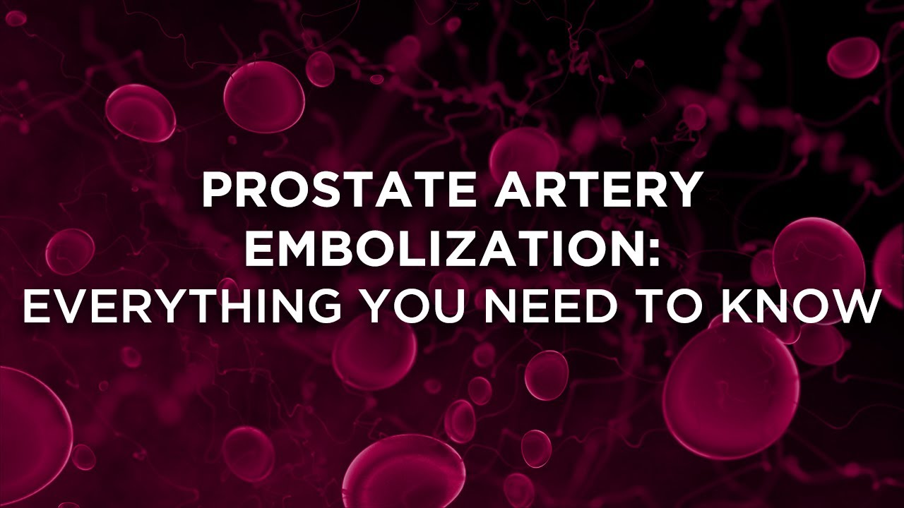 Prostate Artery Embolization: The Future of Prostate Enlargement Treatment | Dr. Ramkrishna Patel