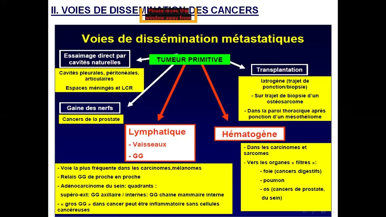 METASTASES 🤩 meilleure explication par Pr OUKID 🤩 anapath