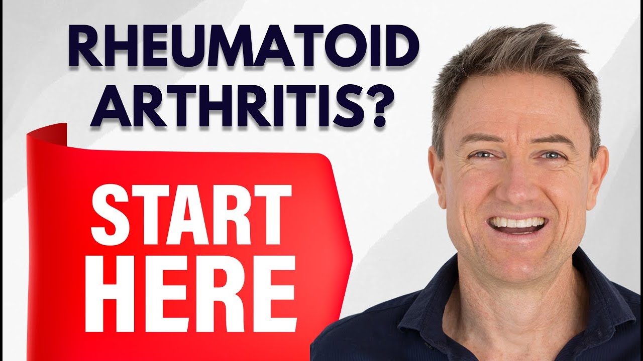 Rheumatoid Arthritis Natural Treatment - Where To Start?