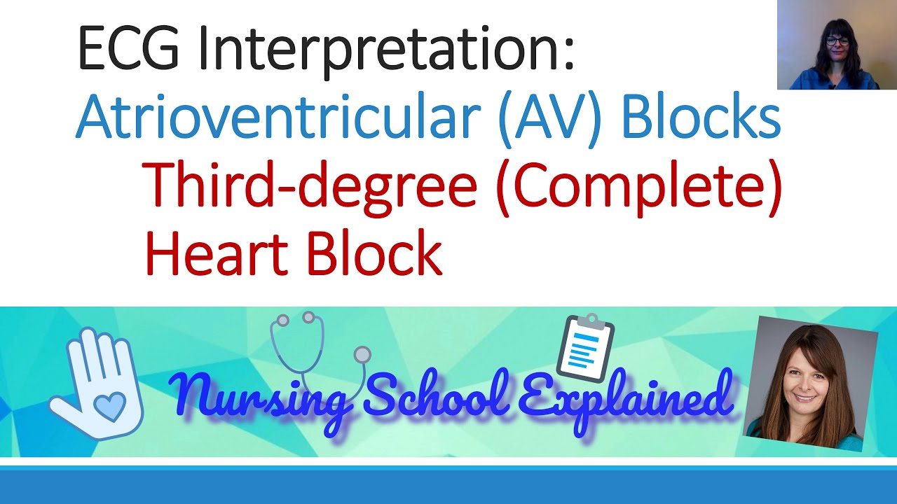 Third Degree/Complete AV (Heart) Block
