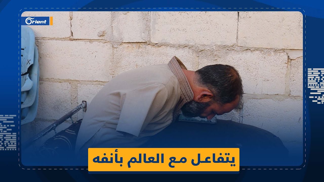 بعد بتر يديه.. عبد الصمد دياب يتفاعل مع العالم من خلال أنفه ولسانه