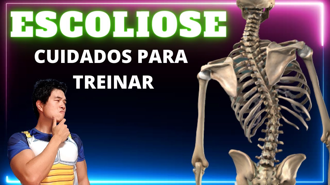 ESCOLIOSE - CUIDADOS NA MUSCULAÇÃO