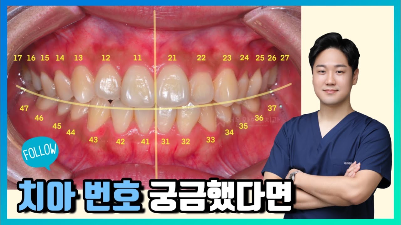 치아 번호 궁금했다면 - FDI, Palmer 치아 표기법 (숫자, 알파벳) Tooth numbering system in Korea