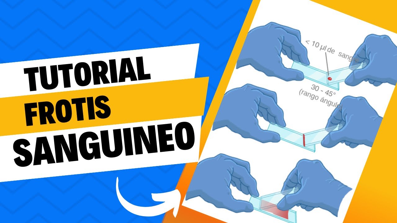 🔬 Como Hacer El Frotis Sanguíneo Perfecto: Técnica Paso a Paso en 5 Minutos