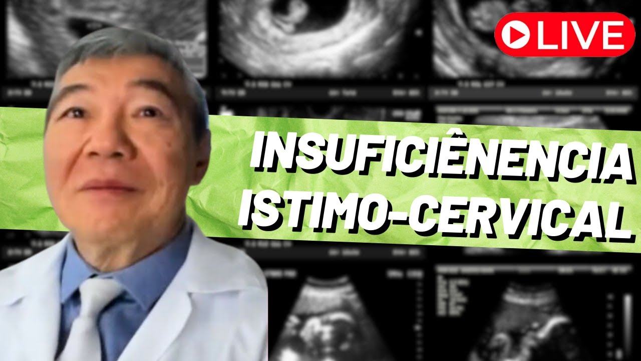 AO VIVO: INSUFICIÊNCIA ISTIMO-CERVICAL