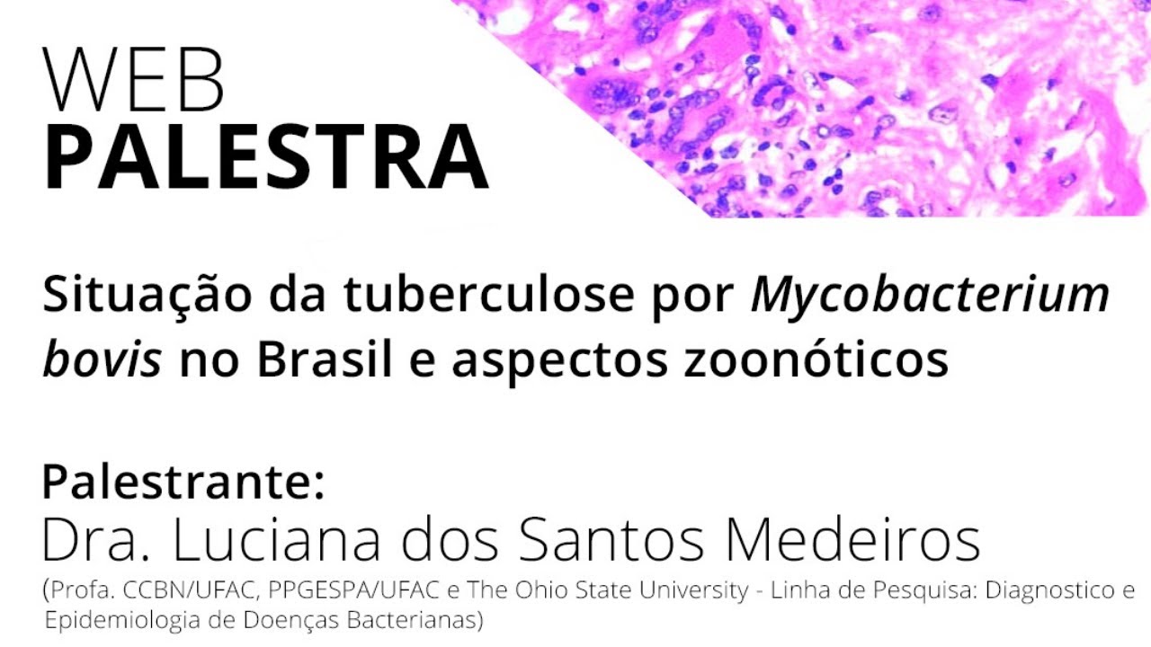 [WEBPALESTRA]Situação da tuberculose por Mycobacterium bovis no Brasil e aspectos zoonóticos
