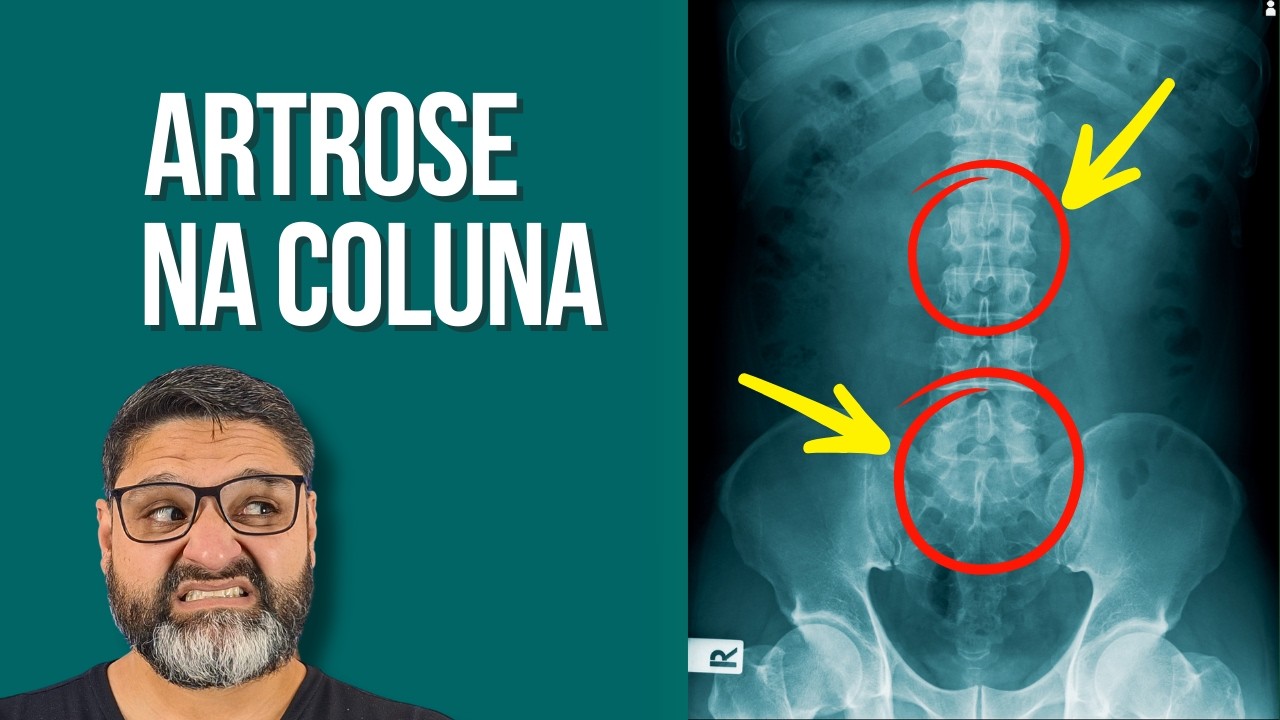 O Melhor Exercício do Mundo para ARTROSE NA COLUNA LOMBAR