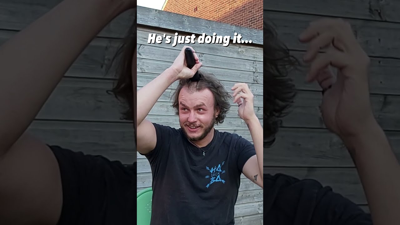 Thinning Hair - Winning Head #Transformation