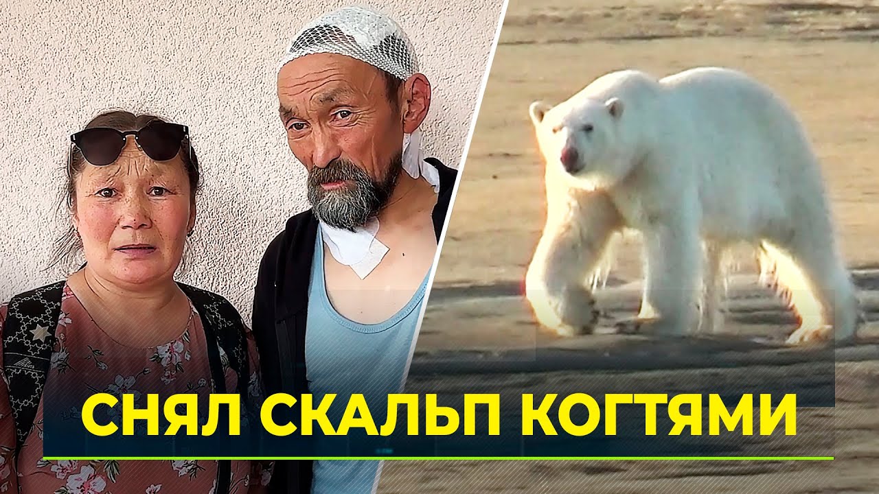 Выжившую после нападения медведя женщину выписали из больницы