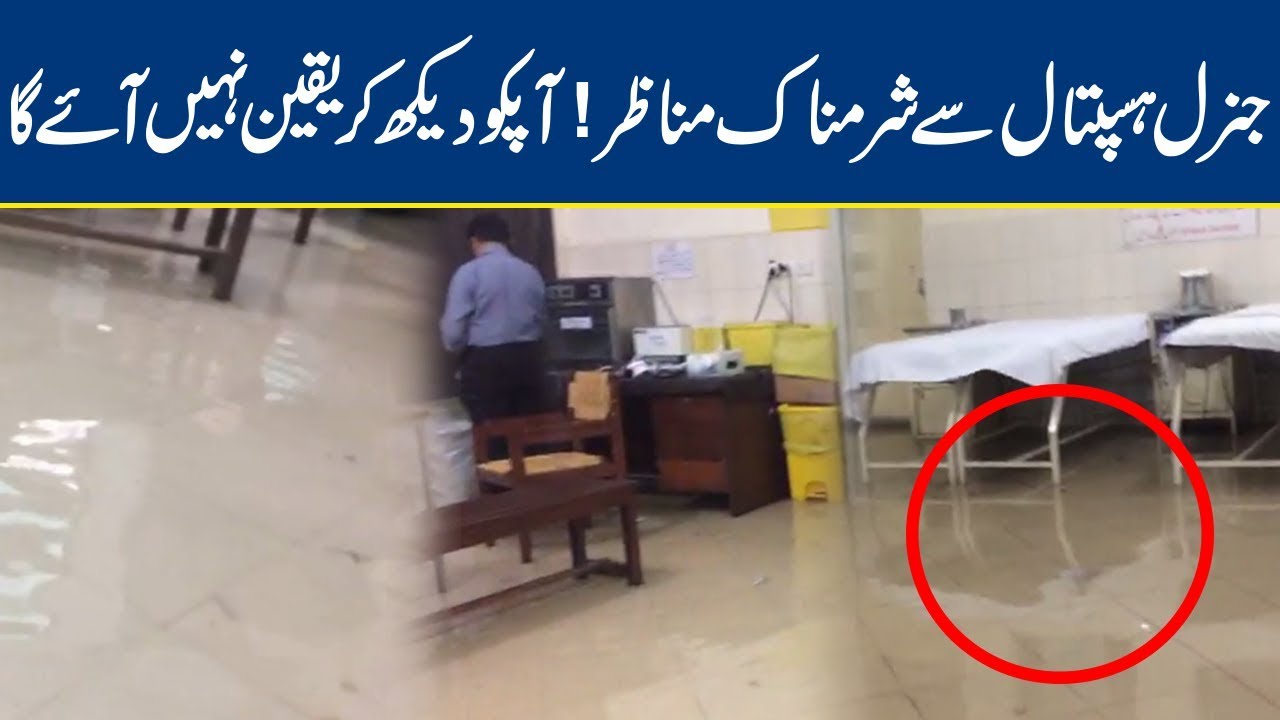 Yours Eyes Wont Believe These Embarrassing Scenes in General Hospital