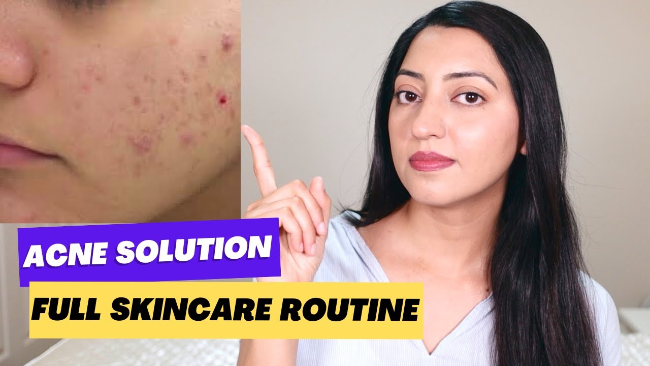 Complete Skincare Routine for Acne