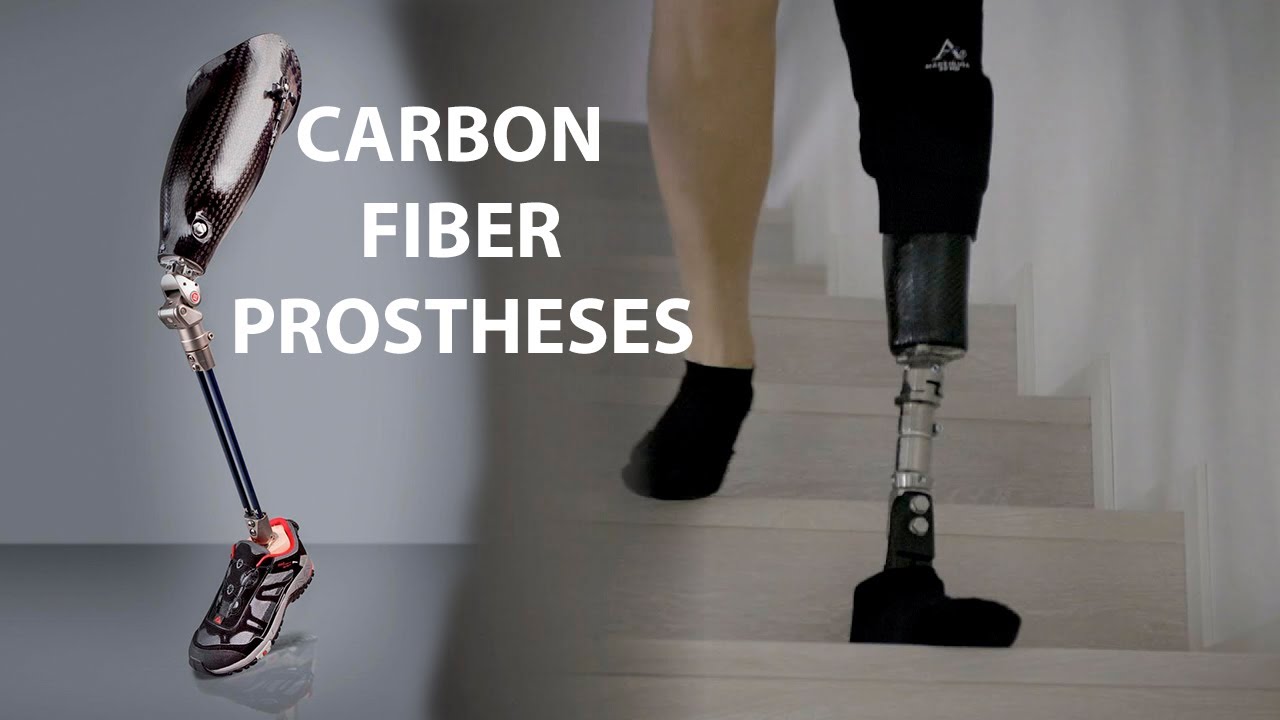 Carbon Fiber Prostheses | Prosthetic leg | Prosthetic arm | Cyborgs World
