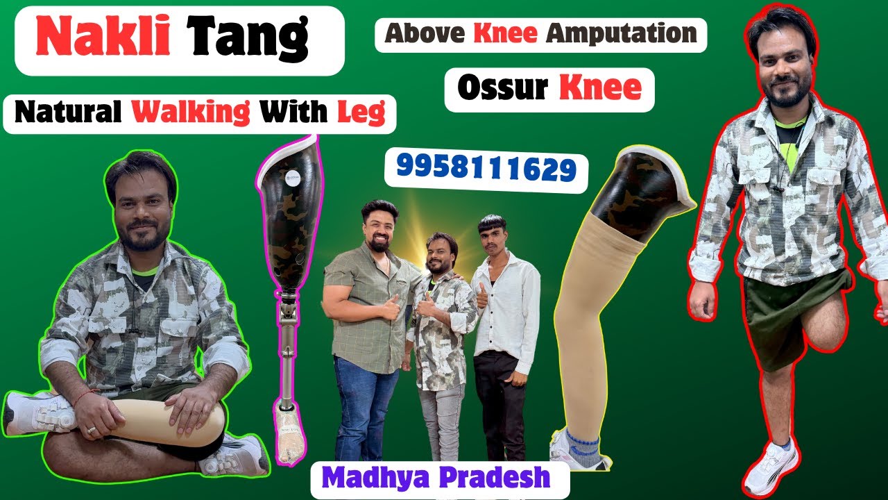Ossur India | Above Knee Prosthetic Leg |Pneumatic Knee Joint |Breeze Foot | #ossur #artificiallimb