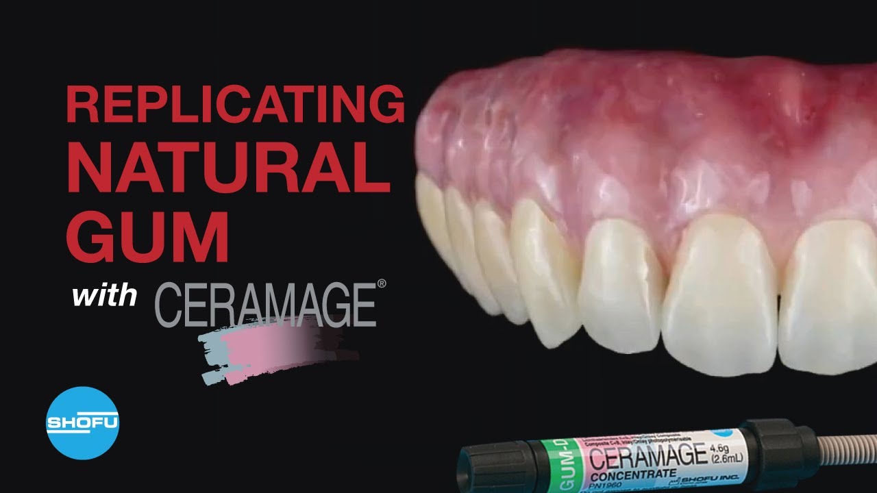 Replicating the natural gum with Ceramage