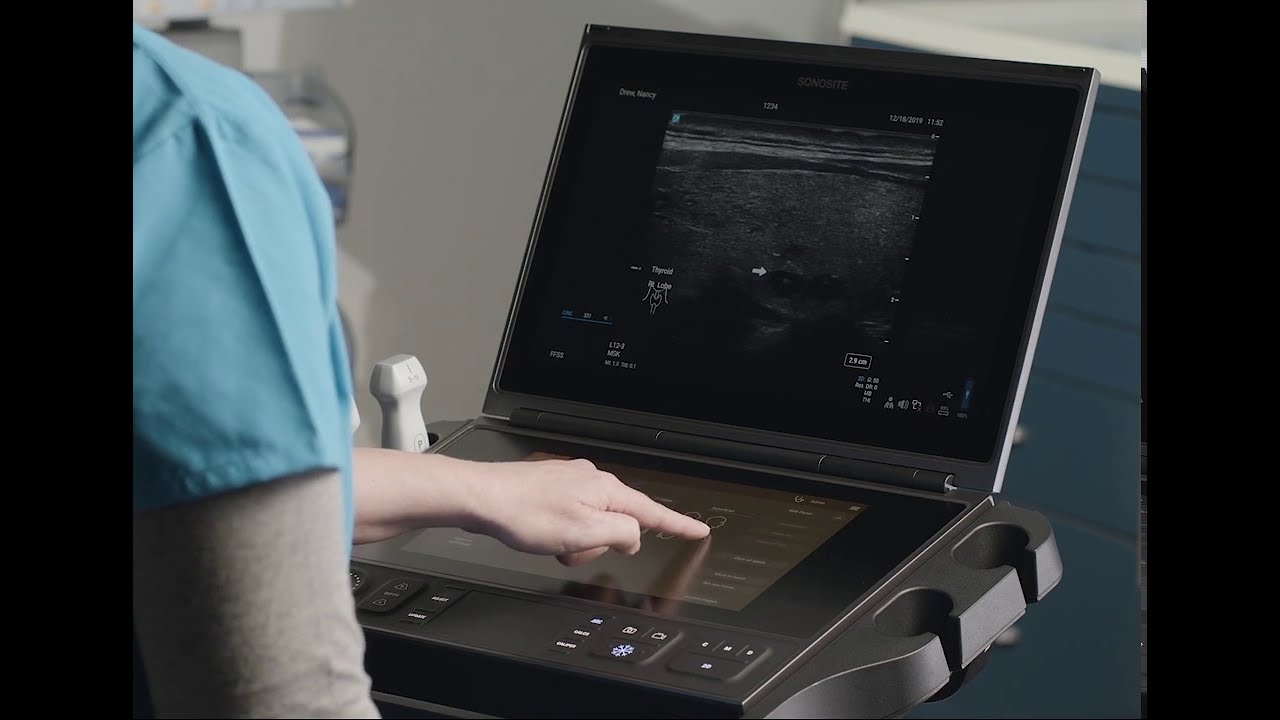 Sonosite PX Help Video - Annotating an Image
