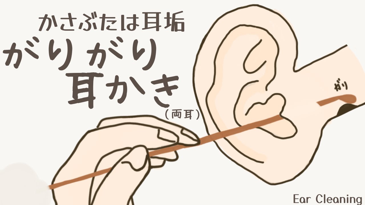 【ASMR】かさぶたは耳垢がりがり耳かき（両耳） Ear Cleaning【No Talking】