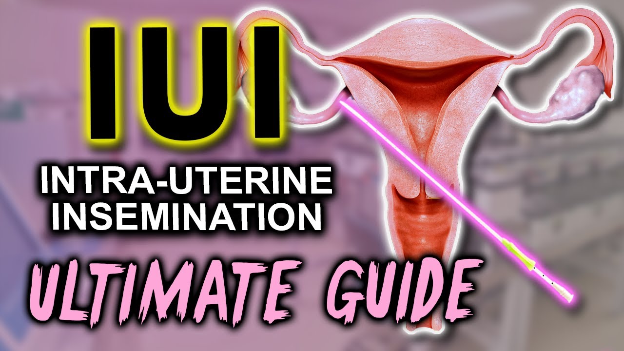 IUI - Fertility expert secrets for maximum pregnancy rates