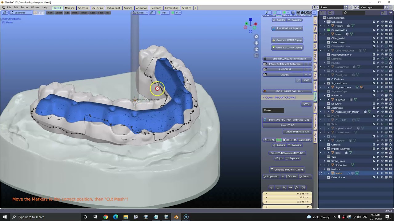 Making an implant denture over a scanned bar