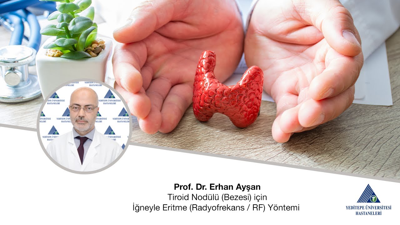 Tiroid Nodülü (Bezesi) için İğneyle Eritme (Radyofrekans / RF) Yöntemi / Prof. Dr. Erhan Ayşan