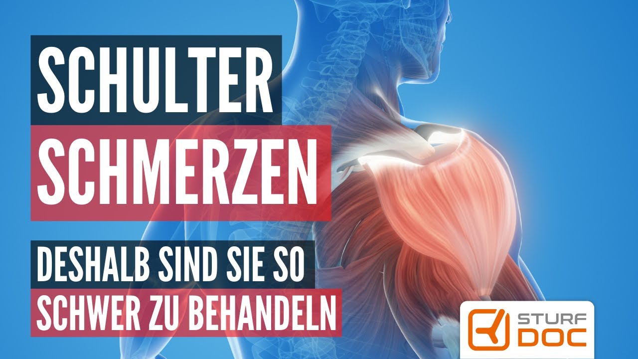 Schulterschmerzen sind kompliziert - Das sind die Gründe