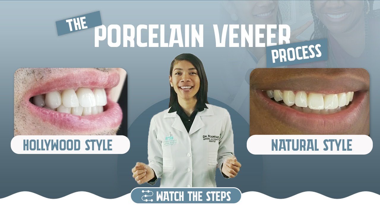 CELEBRITY SMILE 🤩 PORCELAIN VENEERS / See The Process (+ 15 years lasting 100% Ceramic Veneers💎)
