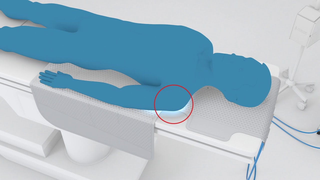 4.  Patient Warming with Allon®: Getting Started