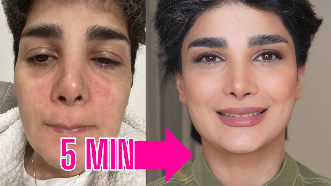 Beauty Secrets for Sensitive Skin: How to Rock Makeup with Seborrheic Dermatitis!