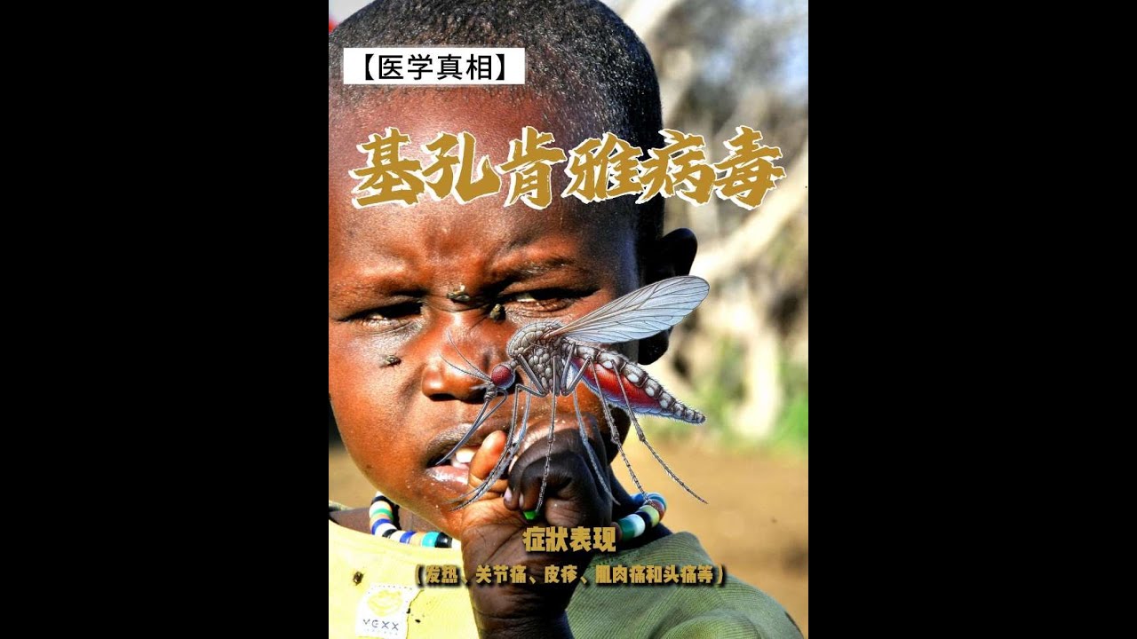 《基孔肯雅病毒》，它是一种至今仍让全世界束手无策的恐怖敌人。#科普 #中國醫 #百科密码 #抖出健康知识宝藏 #知识渊博 #science #科普一下 #熱門