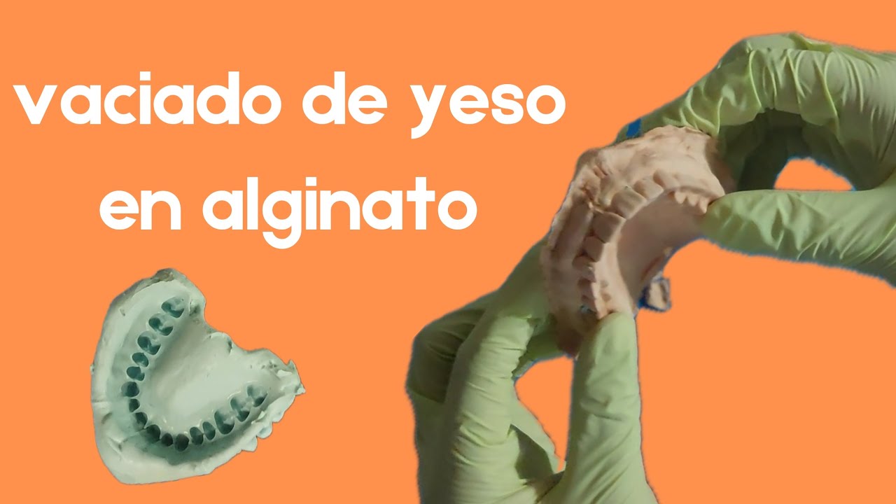 Vaciado de yeso en impresión de alginato 🦷