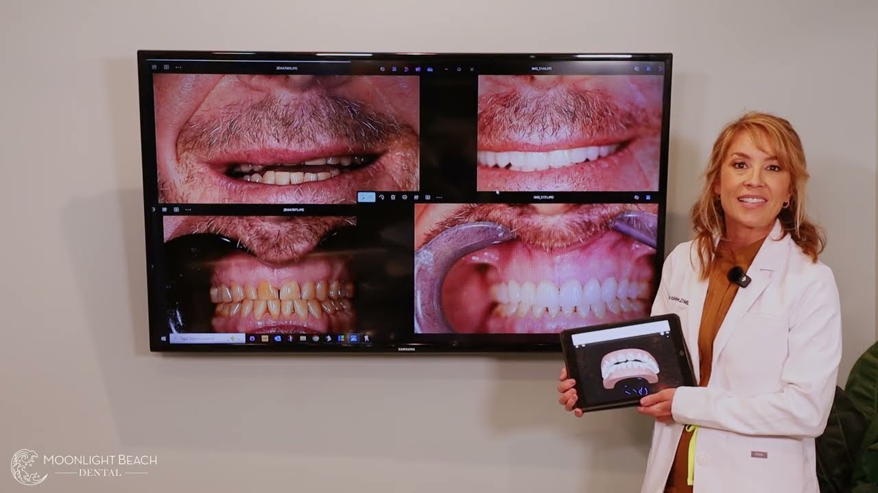 Пример из практики: Полное преображение улыбки