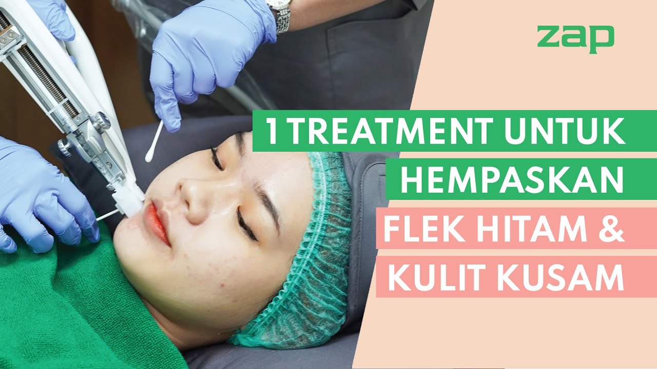 1 TREATMENT UNTUK HEMPASKAN FLEK HITAM  & KULIT KUSAM