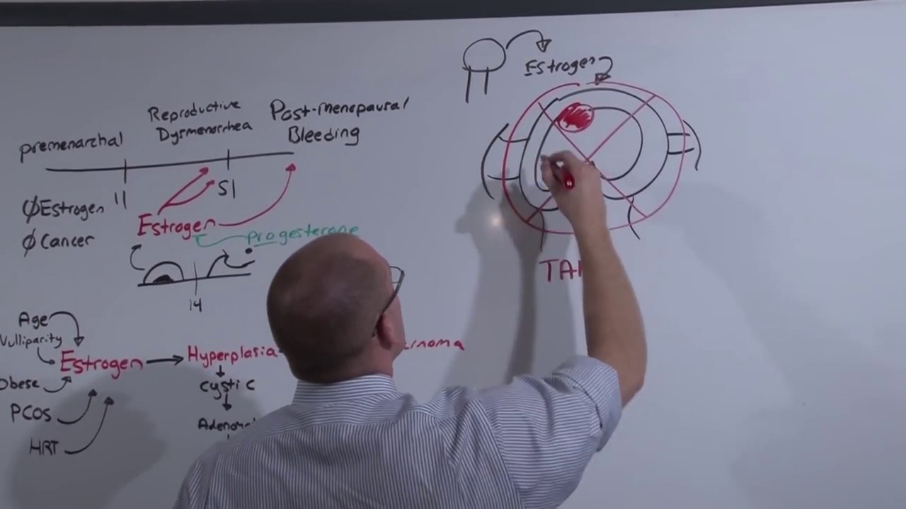 Gyn  Endometrial Cancer   The Medical Education