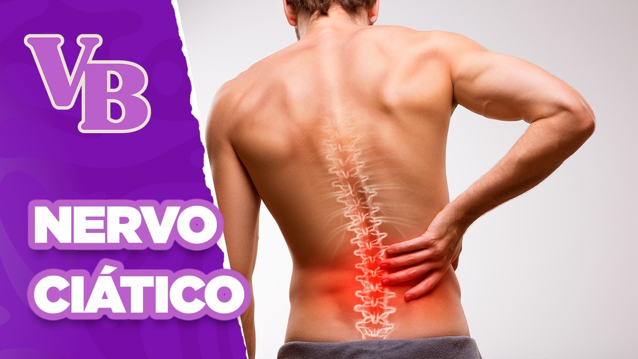Dor no nervo ciático: entenda as causas, sintomas e como tratar - Você Bonita (09/06/2025)