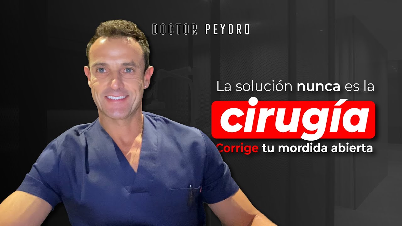 La CIRUGÍA ORTOGNÁTICA, no sirvió ante esta MORDIDA ABIERTA