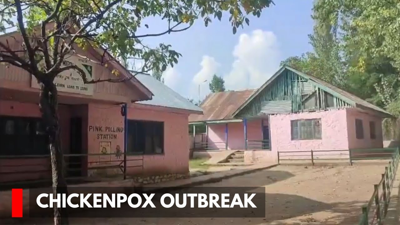 Baramulla: Govt School Closed Following Outbreak of Chickenpox
