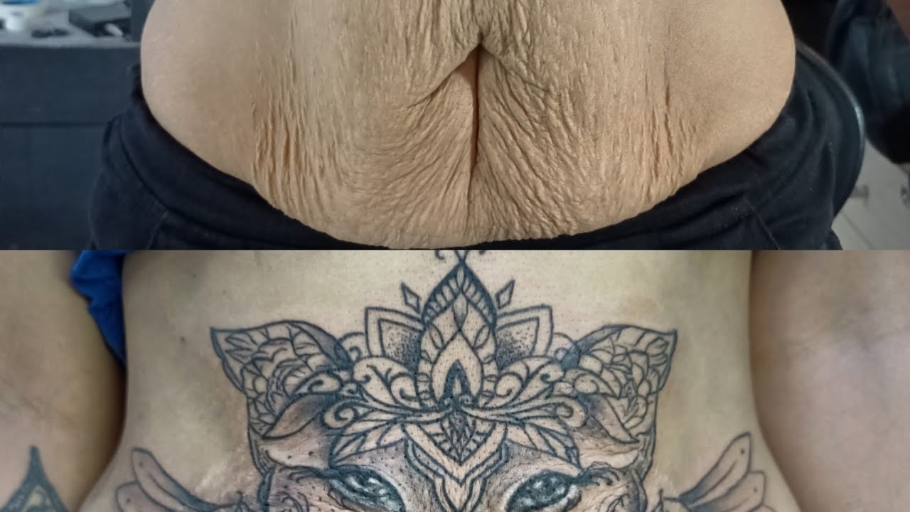stretch marks cover-up tattoo l by Shaikh M Sarkar l skin inks tattoo - mumbai