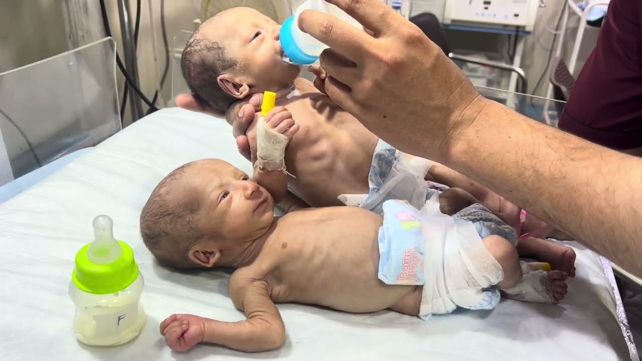 A tiny premature baby who fought bravely in our NICU is now fully recovered and ready to go home. 💕