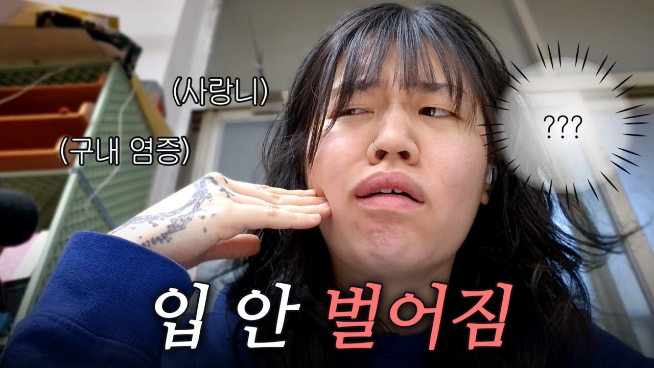 갑자기 입이 안 벌어지게 된 소녀의 이야기🙃 | 사랑니, 구내염증, 치과, 잇몸치료, 식단, 야채찜, 알리오올리오, 니지산지, 굿즈, 일본어 공부