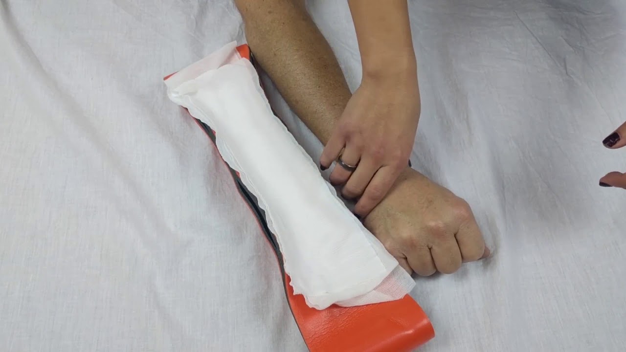 The SAM Splint - Flexible and Versatile