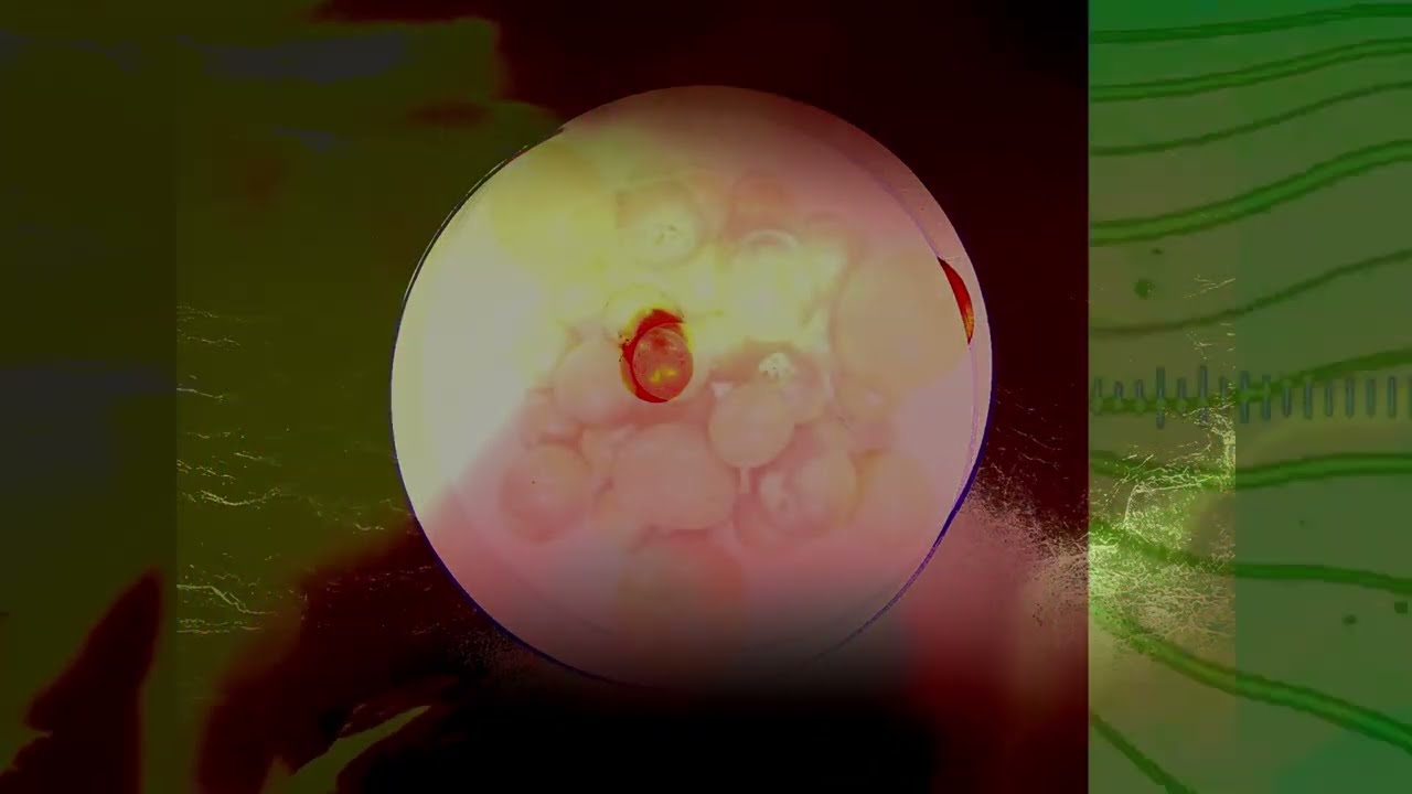 Order 2 Disorder Trailer#1