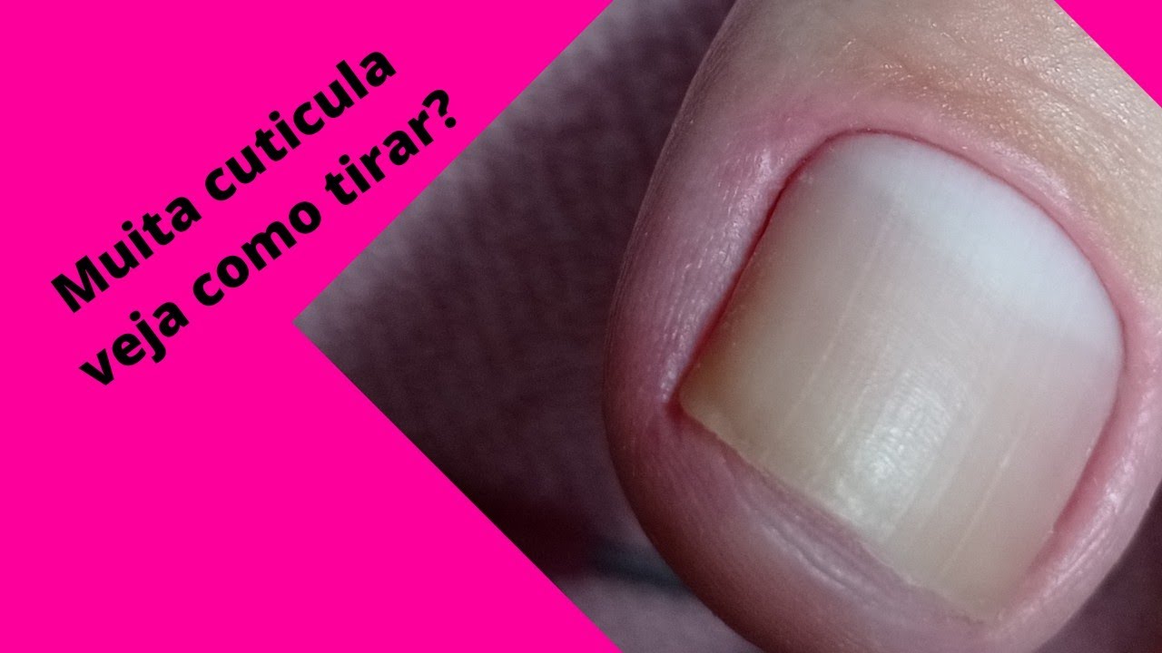 Unha do pé como fazer?Veja como fazer a cutilagem pé, cutilagem funda!