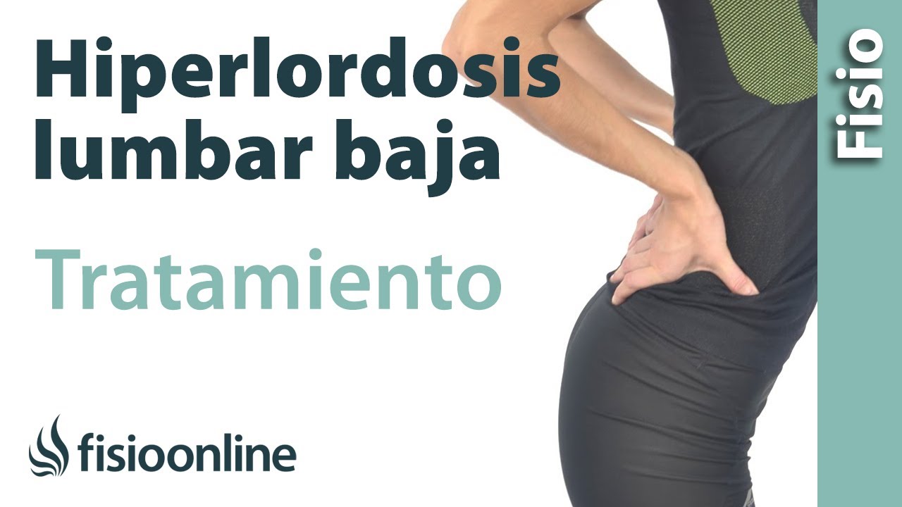 Hiperlordosis lumbar baja - Qué es, causas, síntomas y tratamiento