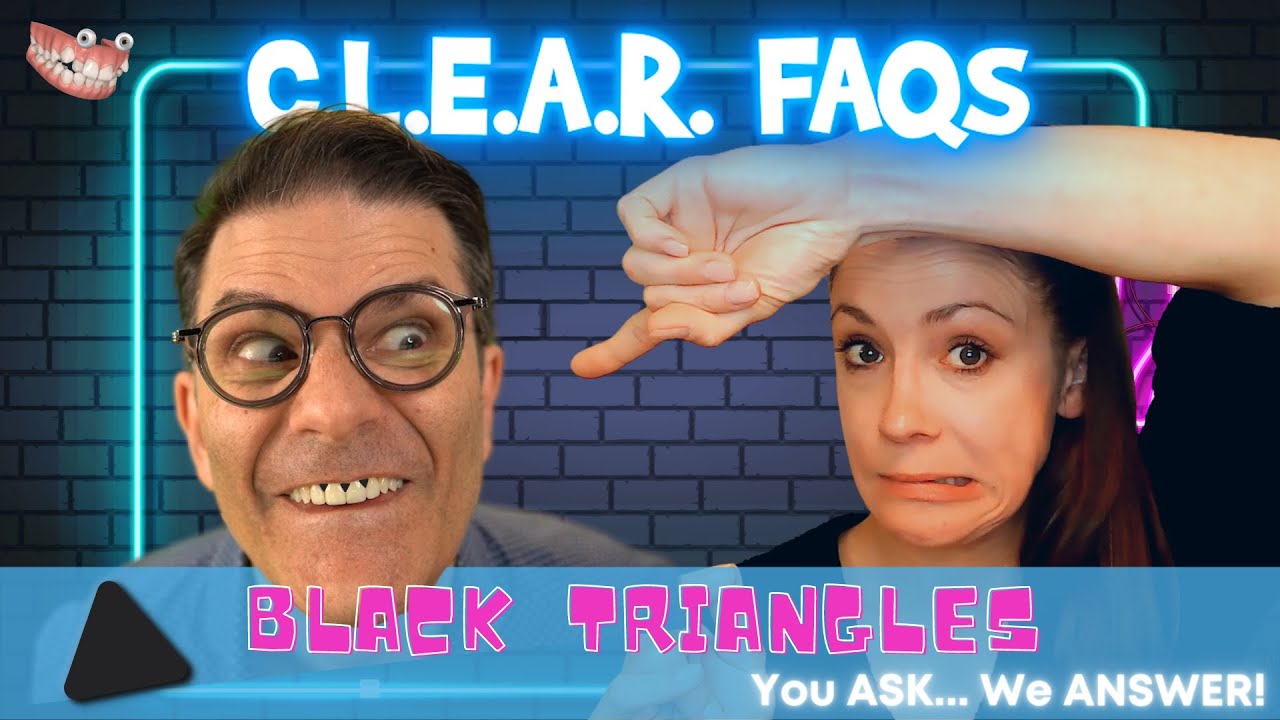 How to manage black triangles when using Invisalign clear aligners?