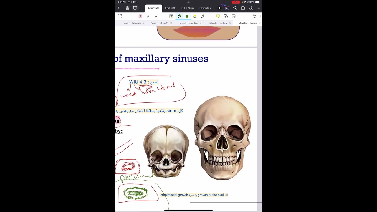 Oral biology 22 (Maxillary sinus ) ivory batch 🦷